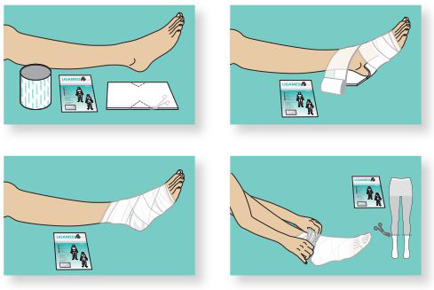 LIGASANO in the podological and diabetological practice Ligamed